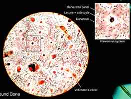 模仿人骨奇妙微觀結構 科學家研製超強鋼材