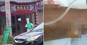 山東陽谷炭疽病疫情 大爆發