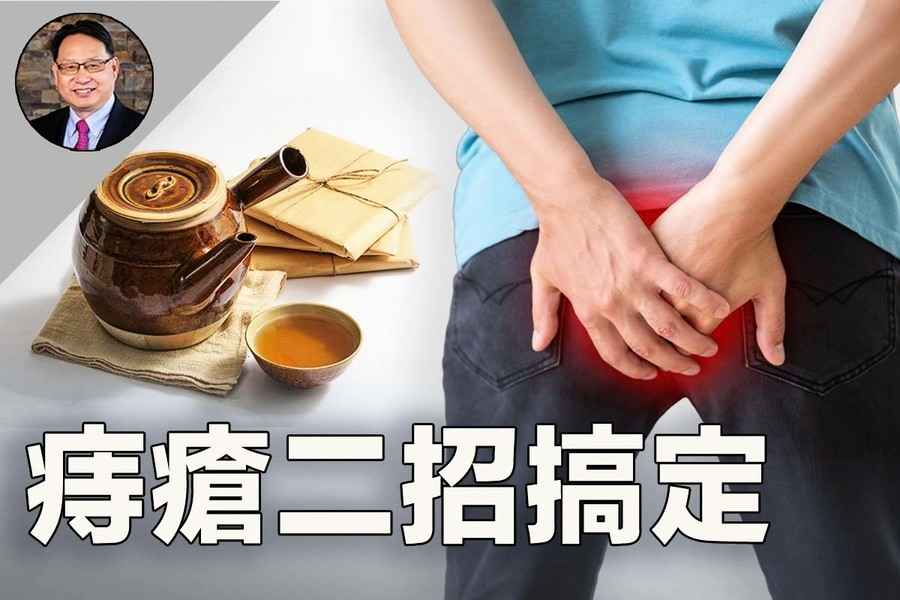 痔瘡反反覆覆 中醫調理助你徹底擺脫痛苦