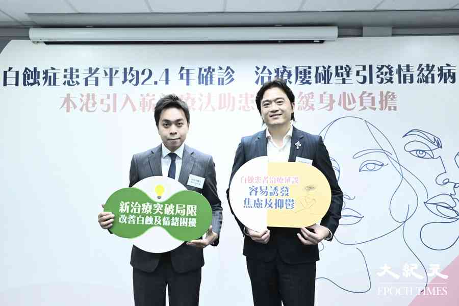 本港引入新療法可改善白蝕症病情