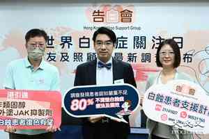 逾七成白蝕症患者渴望復色 港引入新外塗藥物