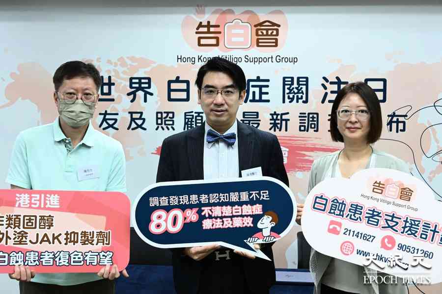 逾七成白蝕症患者渴望復色 港引入新外塗藥物
