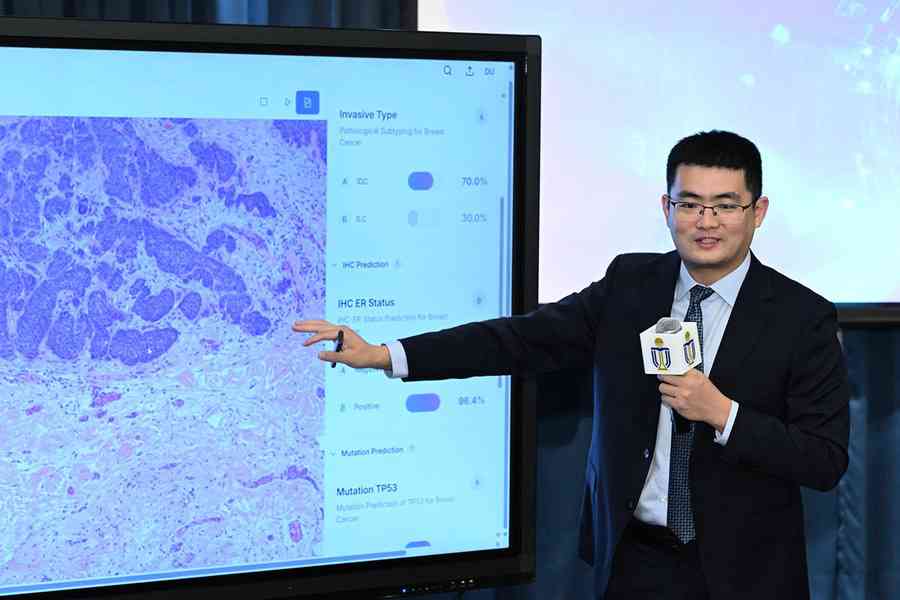 科大研發AI系統 多種癌症診斷準確率逾95% 