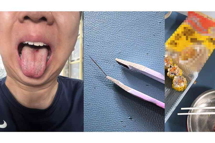 蟹籽燒賣藏鐵針刺傷舌頭 食環署介入調查 AEON下架涉事產品