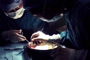 國際醫生組織：中共器官移植改革是謊言
