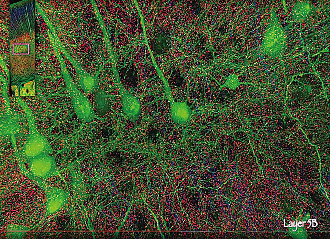 人腦的組織結構極其複雜，圖為顯微解剖學染色方法所見腦細胞的局部份布特徵。（影片截圖）