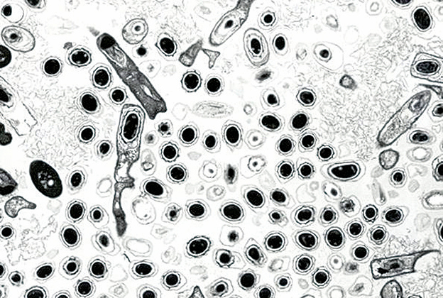 顯微鏡下觀察到的一些細菌圖。（Getty Images）