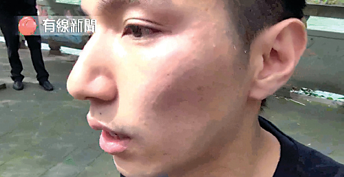 有線電視記者陳浩暉周日採訪四川地震十周年期間被人毆打受傷，施襲者事後被認出是大陸政府官員。（有線新聞截圖）