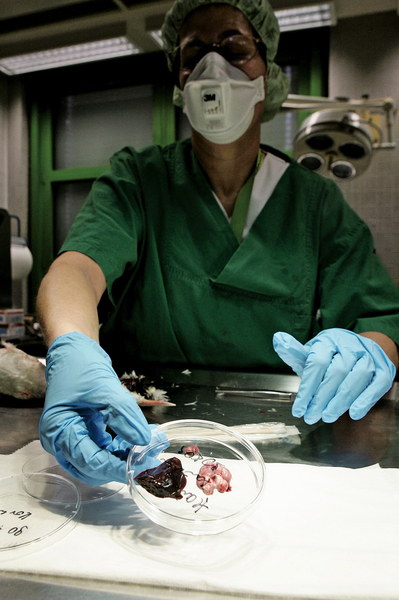 實驗室培育的器官有望用於移植