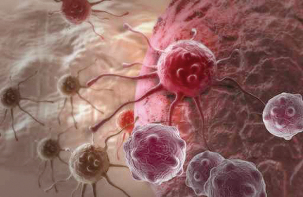 巴西科學家研究出一種直接攻擊癌細 胞的癌症新療法。圖為一種癌細胞。 （Fotolia）