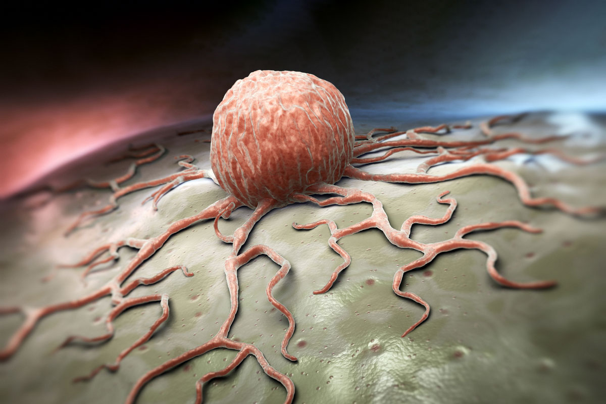 癌細胞對糖如饑似渴，怎樣有效把癌細胞「餓死」？（Shutterstock）