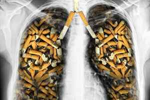 為甚麼大多數煙民沒有患肺癌 研究析因