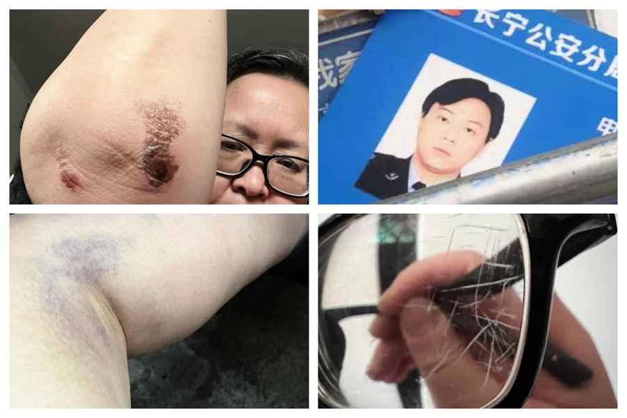 上海女子做核酸咽喉受傷 外出尋醫遭警毆打