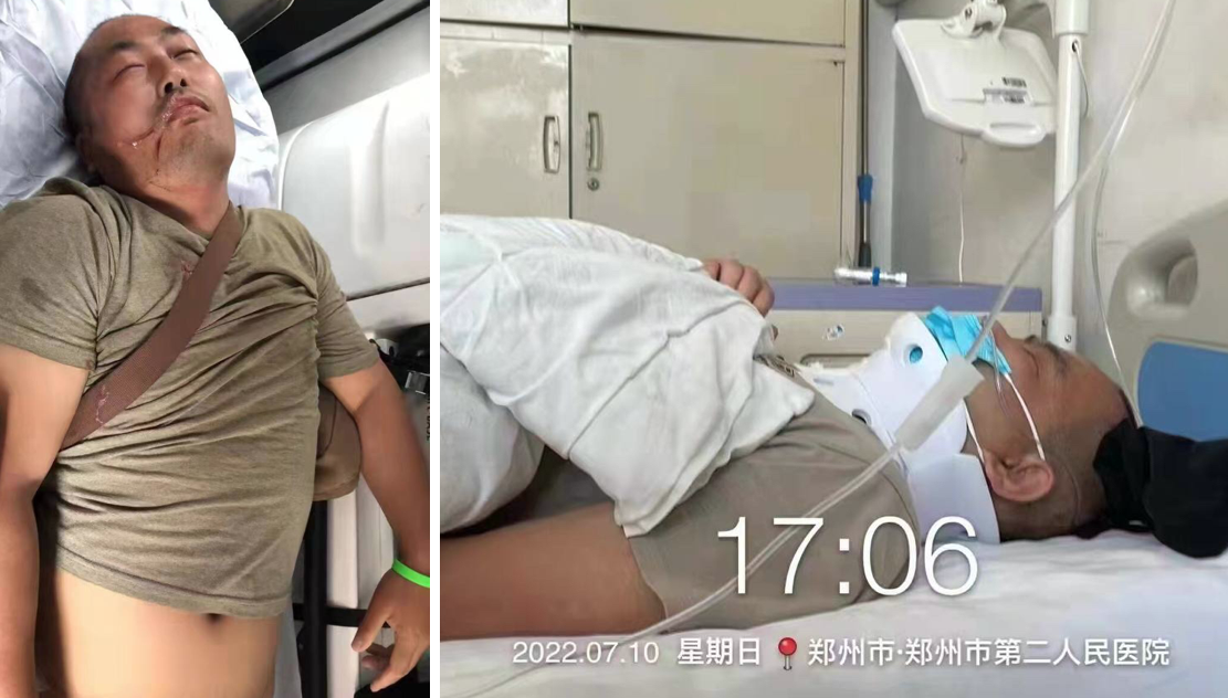 7月10日警民衝突當中， 一名存戶被打到頸部骨折， 目前在鄭州市第二醫院，昏迷未醒。（ 受訪者提供）