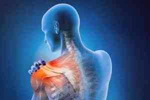 超越藥物和手術:肩周炎的綜合治療方案