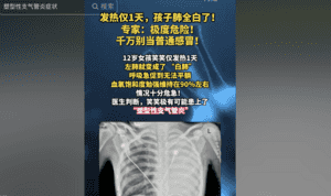 浙江女孩發熱一天後左肺全白 原因成謎