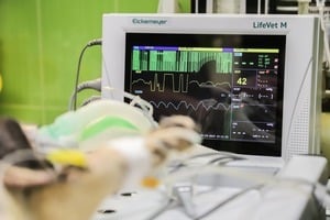 提早感應死亡 德國研發高靈敏度心臟雷達