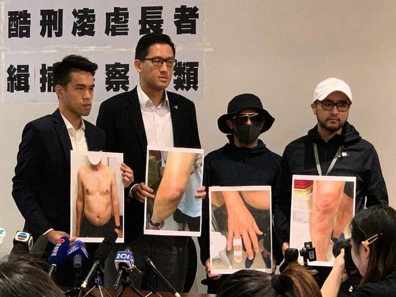 香港軍警私刑凌虐長者影片被曝光 眾人憤怒