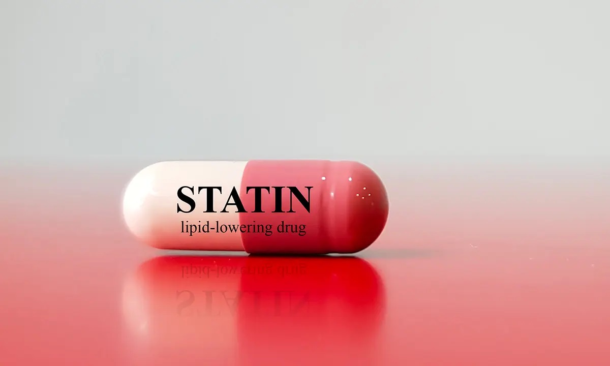 這些流行的他汀類藥物（statins）可能會增加胰島素抵抗，加劇肌肉疼痛和疲勞。 （Shutterstock）
