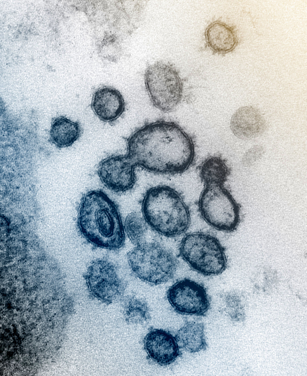 中共病毒（俗稱武漢病毒、新冠病毒）外圍有明顯的尖峰如冠狀，因此被稱為冠狀病毒。圖片來源：NIAID-RML。