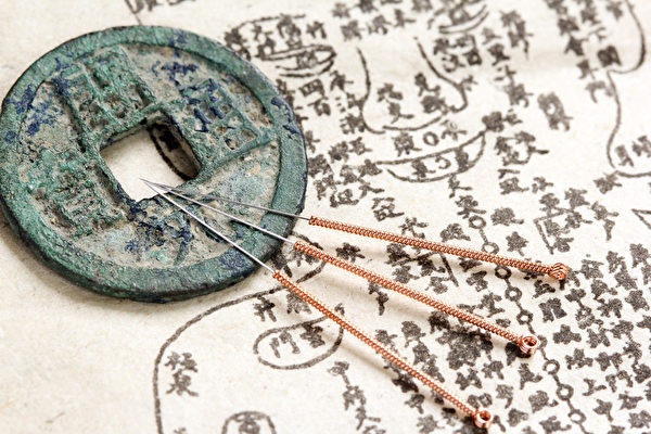 名醫龐安常的神奇針灸術