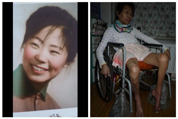 圖左:葉旭霞健康時的容貌。圖右:葉旭霞因不放棄修煉法輪功,在中共勞教所被毆打致重傷,導致殘疾和癱瘓。(圖片由葉旭霞女兒提供,大紀元合成)