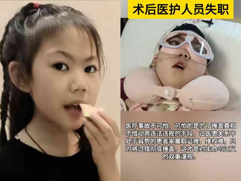 9歲女童術後成植物人 河南醫院篡改病歷