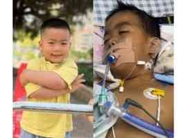 扁桃體微創手術後 廣東3歲男童竟「腦死亡」