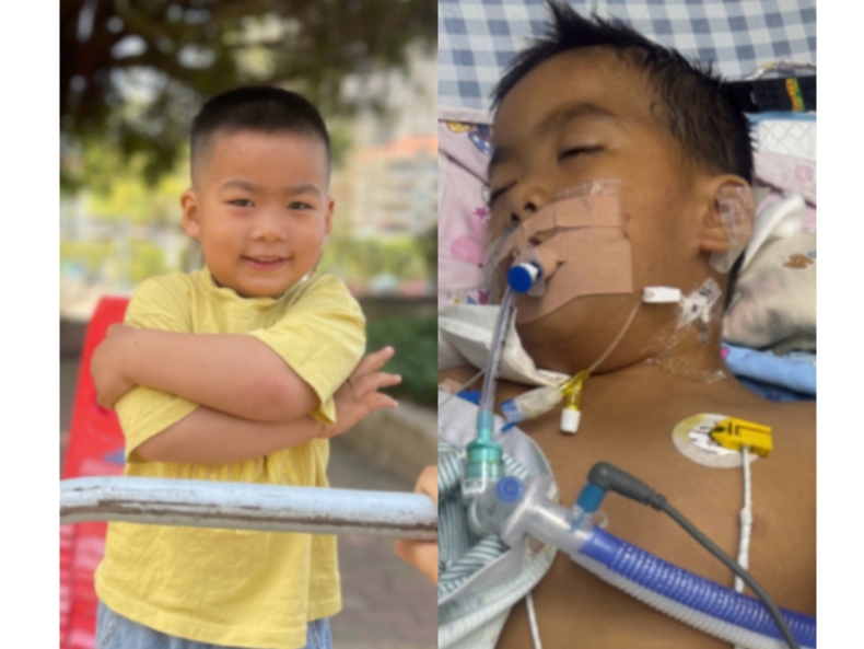 扁桃體微創手術後 廣東3歲男童竟「腦死亡」