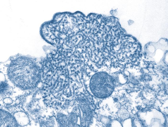 新冠肺炎（中共肺炎）疫情未趨緩，專家示警立百病毒具有造成下一波大流行的風險。（維基百科公有領域）