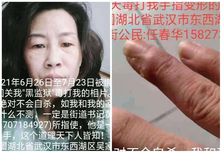 武漢女訪民被關入黑監獄28天 遭羞辱電擊