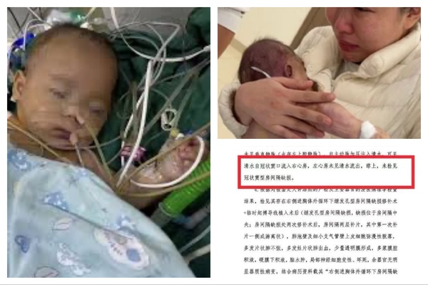 寧波女嬰小洛熙驗屍報告出爐 手術存在重大失誤