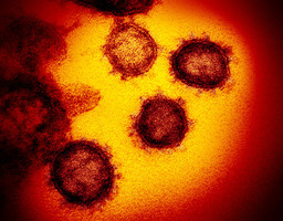 研究：中共病毒傳染力遠高於WHO估計值