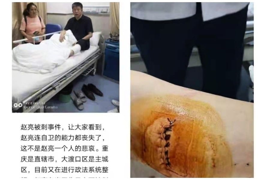 重慶訪民趙亮遭維穩人員刺傷左腿 縫40餘針
