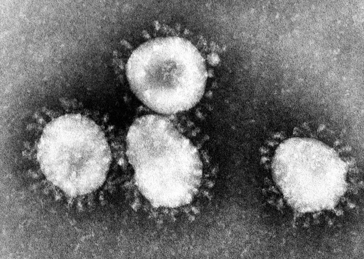 中共病毒呈圓形，外套膜上有突出的「棘蛋白」（spike protein，又稱長釘蛋白），看上去像皇冠一樣。（Wikimedia Commons）