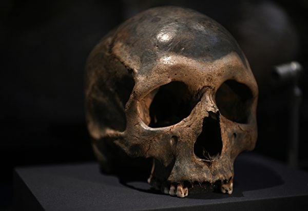 2022年2月14日，英國倫敦，大英博物館（The British Museum）將舉行「巨石陣世界」（The World of Stonehenge）展覽。圖為一個人類頭骨，可見到曾遭到鈍器傷害後癒合的痕跡。（Daniel Leal/AFP）