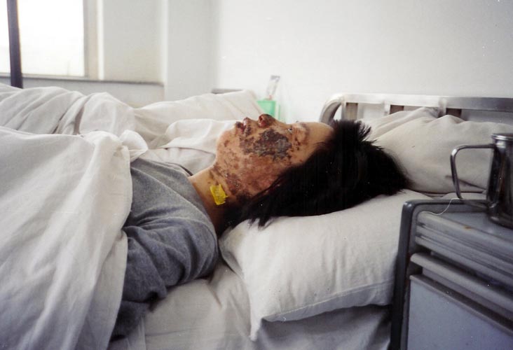 一張毀容照震撼世界：高蓉蓉案曝酷刑黑幕