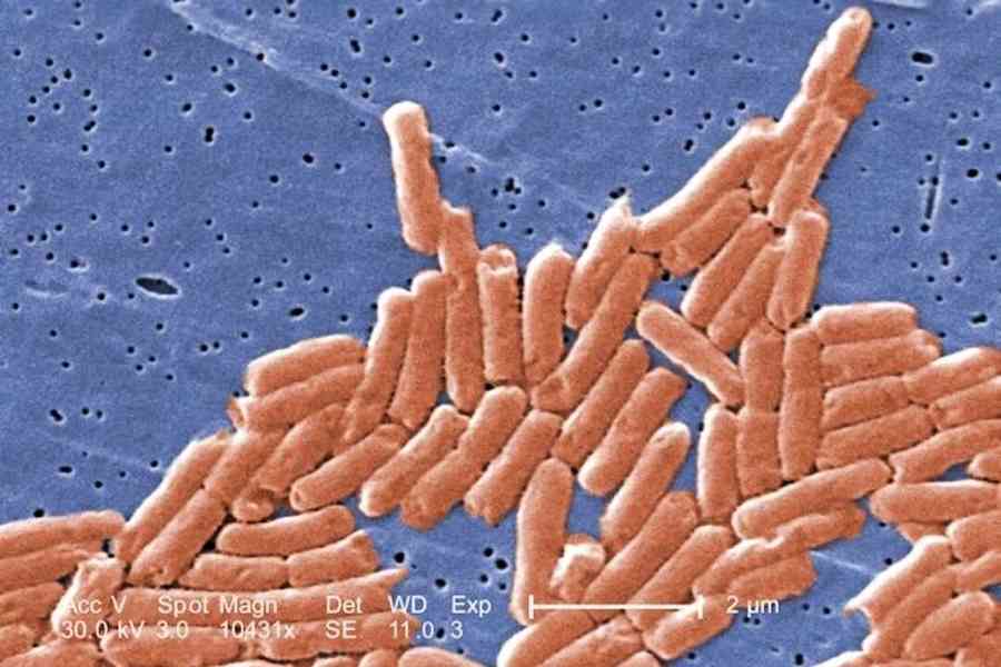 全球警報！WHO：抗生素耐藥性正威脅全球健康