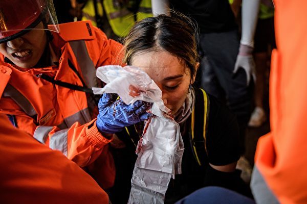 8月11日反送中尖沙咀現場一名女子遭警方布袋彈射穿眼罩、擊中右眼球及鼻樑骨，當場血流如注。報道指她現時傷勢嚴重，右眼球爆裂，視力或永久受損。（ANTHONY WALLACE/AFP/Getty Images）