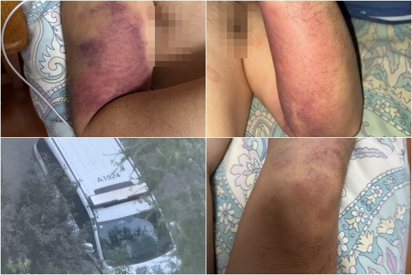 北京維權人士錢大龍遭警方毆打 自殺未遂