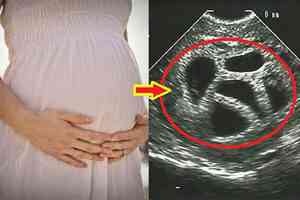 北京退休人員產檢也可報銷 引爭議