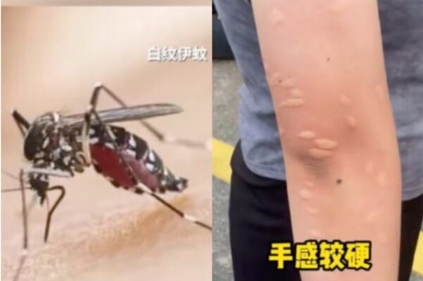 九天劍：陌生的基孔肯尼亞 熟悉的新冠消殺