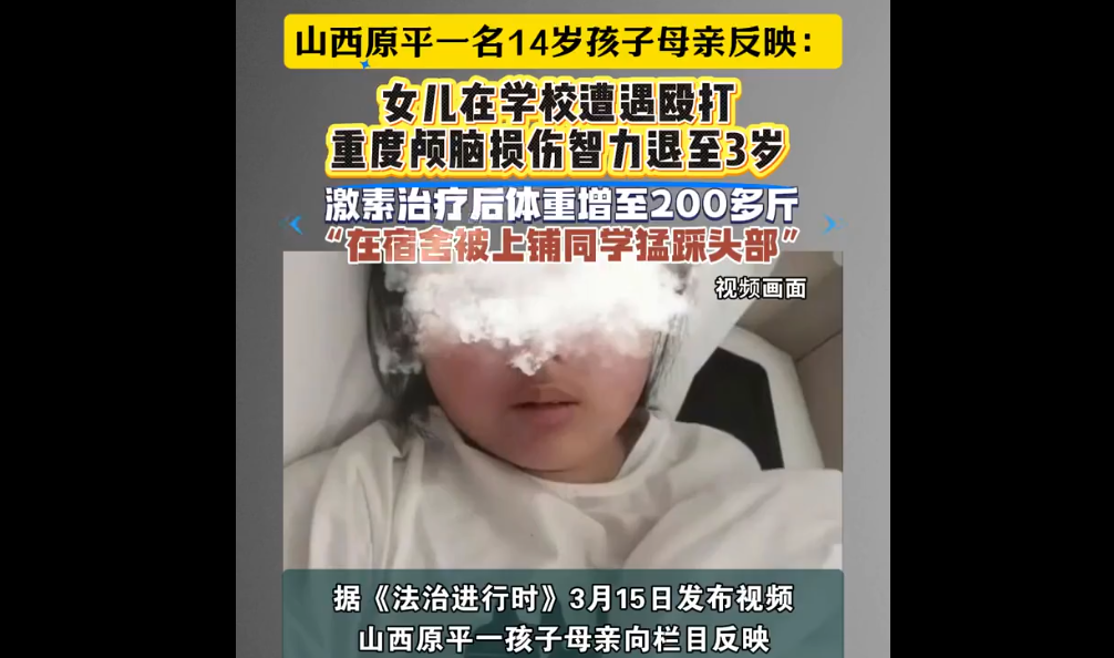 山西14歲女生疑遭霸凌致顱腦重傷 官方通報遭轟