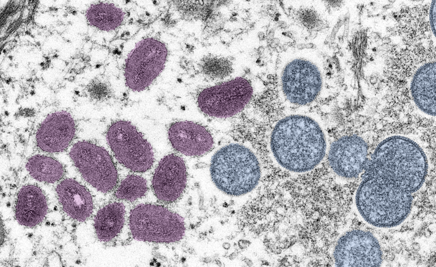 世衛宣布猴痘為全球公共衛生緊急狀況