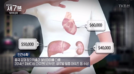 中國移植醫院的一位朝鮮族護士說：「腎臟移植需要1億2千萬至1億4千萬韓圜，如果捐贈1千5百萬韓圜，可以儘快安排移植手術。」（ TV朝鮮《調查報告7》截圖）