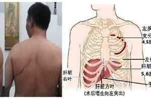 張菁：內蒙集中採集男性血樣背後的罪惡