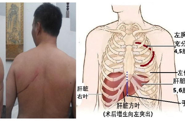 張菁：內蒙集中採集男性血樣背後的罪惡