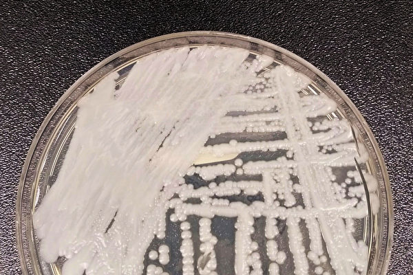 美國CDC警告：可致命的耳念珠菌病例激增