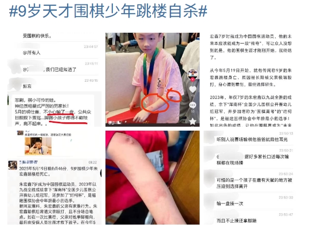 傳中國9歲圍棋天才少年不堪家暴 跳樓輕生