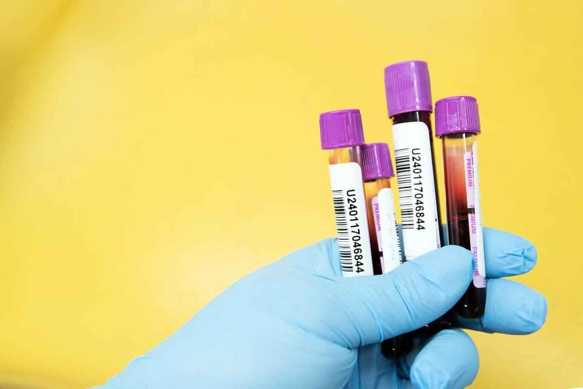 一項新研究指出，通過一項簡單的血液檢查，就能夠發現患者潛在的多種癌症疾病。（Pixabay）